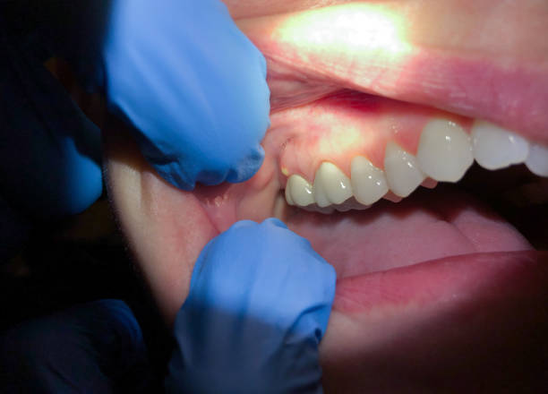 Best Emergency Gum Pain Relief  in Atlantis, FL