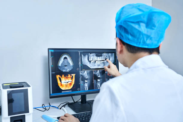 Best Dentist for Tooth Abscess  in Atlantis, FL